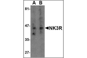 Western blot analysis of NK3R in RAW264. (TACR3 Antikörper  (Center))