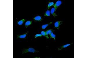 IF analysis of RDX using anti-RDX antibody (ABIN7602767). (Radixin Antikörper  (C-Term))