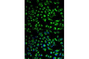 Immunofluorescence analysis of HeLa cells using SPAM1 antibody.