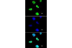 Histone H4 pan-acetyl antibody (pAb) tested by immunofluorescence.