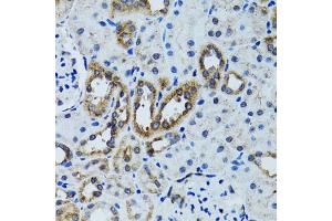 Immunohistochemistry of paraffin-embedded mouse kidney using RPN1 antibody. (RPN1 Antikörper)