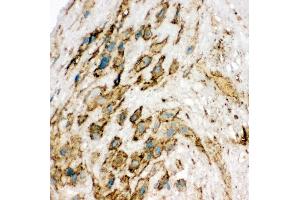 Anti-VEGF Receptor 2 antibody, IHC(F) IHC(F): Human Placenta Tissue