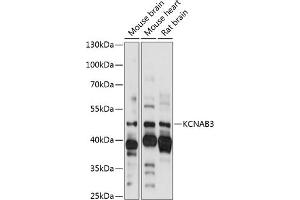 Western blot analysis of extracts of various cell lines, using KCN antibody (ABIN7269483) at 1:1000 dilution. (KCNAB3 Antikörper  (AA 285-404))