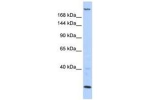 Image no. 1 for anti-Trinucleotide Repeat Containing 6B (TNRC6B) (AA 396-445) antibody (ABIN6743011) (TNRC6B Antikörper  (AA 396-445))