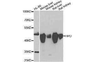 Western blot analysis of extracts of various cell lines, using HPD antibody. (HPD Antikörper  (AA 1-393))