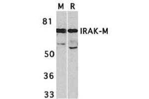 Western Blotting (WB) image for anti-Interleukin-1 Receptor-Associated Kinase 3 (IRAK3) (C-Term) antibody (ABIN1030446) (IRAK3 Antikörper  (C-Term))