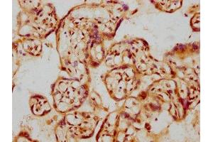 Immunohistochemistry (IHC) image for anti-Glial Cell Line Derived Neurotrophic Factor (GDNF) antibody (ABIN7127513)
