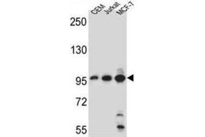 Western Blotting (WB) image for anti-Aftiphilin (AFTPH) antibody (ABIN5022169) (Aftiphilin Antikörper)