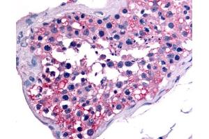 Immunohistochemistry (IHC) image for anti-Nuclear Receptor Subfamily 6, Group A, Member 1 (NR6A1) (Ligand Binding Domain) antibody (ABIN1049149)
