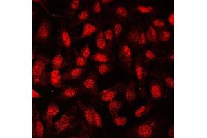 IF analysis of FLI1 using anti-FLI1 antibody (ABIN7599409). (FLI1 Antikörper  (AA 1-452))