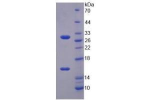 Image no. 1 for Sirtuin 3 (SIRT3) (AA 5-257) (Active) protein (His tag) (ABIN5665902)