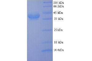 SDS-PAGE (SDS) image for Cfa/I Fimbrial Subunit E (Colonization Factor Antigen I Subunit E, Pilin Subunit) (CFAE) (AA 1-360), (full length) protein (His tag) (ABIN5714078) (cfaE Protein (AA 1-360, full length) (His tag))