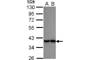 Western Blotting (WB) image for anti-Interferon Regulatory Factor 9 (IRF9) (AA 171-393) antibody (ABIN1498905) (IRF9 Antikörper  (AA 171-393))