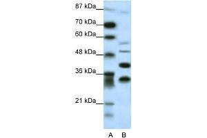 WB Suggested Anti-GFI1 Antibody Titration: 0. (GFI1 Antikörper  (N-Term))