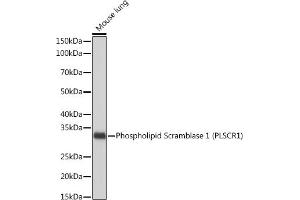 Western blot analysis of extracts of Mouse lung, using Phospholipid Phospholipid Scramblase 1 (PLSCR1) (PLSCR1) Rabbit mAb (ABIN7269354) at 1:1000 dilution.