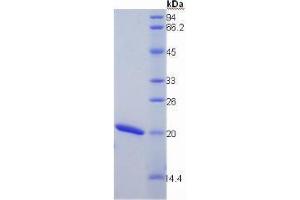 SDS-PAGE analysis of Mouse Cyclophilin B Protein. (PPIB Protein)