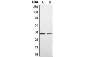 Western blot analysis of BNIP2 expression in HEK293T (A), mouse liver (B) whole cell lysates. (BNIP2 Antikörper  (C-Term))