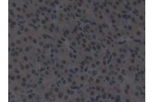 Detection of IRF2 in Mouse Ovary Tissue using Polyclonal Antibody to Interferon Regulatory Factor 2 (IRF2) (IRF2 Antikörper  (AA 1-349))
