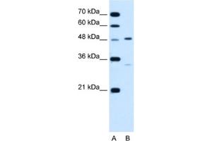 Western Blotting (WB) image for anti-Carbohydrate (Keratan Sulfate Gal-6) Sulfotransferase 1 (CHST1) antibody (ABIN2462855) (CHST1 Antikörper)