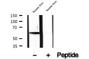 Western Blotting (WB) image for anti-Phosphatidylinositol-4-Phosphate 5-Kinase, Type I, alpha (PIP5K1A) (N-Term) antibody (ABIN6264231)