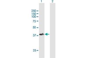 Western Blot analysis of TOM1L1 expression in transfected 293T cell line by TOM1L1 MaxPab polyclonal antibody. (TOM1L1 Antikörper  (AA 1-346))