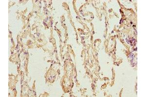 Immunohistochemistry of paraffin-embedded human lung tissue using ABIN7173119 at dilution of 1:100 (TMEM19 Antikörper  (AA 105-217))