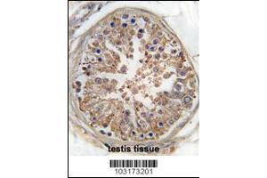 Immunohistochemistry (IHC) image for anti-Protein Kinase, AMP-Activated, gamma 3 Non-Catalytic Subunit (PRKAG3) (AA 265-295) antibody (ABIN5533705)