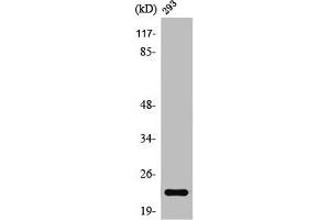 Western Blot analysis of 293 cells using Rab 35 Polyclonal Antibody (RAB35 Antikörper  (Internal Region))