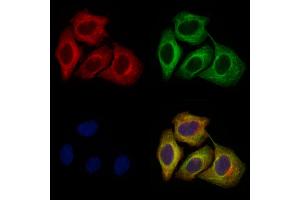 ABIN6264314 and ABIN6274038 staining Hela cells by IF/ICC. (Melanoma gp100 Antikörper  (C-Term))
