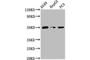 Western Blot Positive WB detected in: A549 whole cell lysate, HepG2 whole cell lysate, PC-3 whole cell lysate All lanes: IFT52 antibody at 5. (IFT52 Antikörper  (AA 325-434))