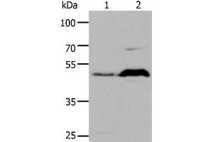 Western Blot analysis of HepG2 cell and Mouse brain tissue using HTR1A Polyclonal Antibody at dilution of 1:1000 (Serotonin Receptor 1A Antikörper)
