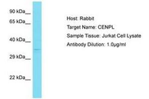 Image no. 1 for anti-Centromere Protein L (CENPL) (AA 108-157) antibody (ABIN6750824) (CENPL Antikörper  (AA 108-157))