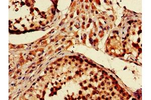 IHC image of ABIN7151093 diluted at 1:600 and staining in paraffin-embedded human testis tissue performed on a Leica BondTM system. (Parkin Antikörper  (AA 1-465))