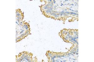Immunohistochemistry of paraffin-embedded human prostate using RNASE13 antibody at dilution of 1:100 (40x lens). (RNASE13 Antikörper)