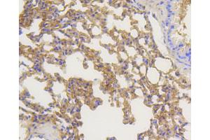 Immunohistochemistry (IHC) image for anti-Arrestin, beta 1 (ARRB1) antibody (ABIN4903044)