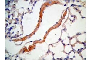 Immunohistochemistry (IHC) image for anti-Cathelicidin Antimicrobial Peptide (CAMP) (AA 140-173) antibody (ABIN2873275)