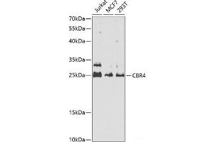Western blot analysis of extracts of various cell lines using CBR4 Polyclonal Antibody at dilution of 1:1000. (CBR4 Antikörper)