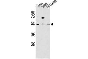Western blot analysis of APOA4 antibody and Jurkat, K562, NCI-H460 lysate (APOA4 Antikörper  (AA 49-79))