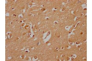 IHC image of ABIN7142045 diluted at 1:200 and staining in paraffin-embedded human brain tissue performed on a Leica BondTM system. (Phospholipase C beta 2 Antikörper  (AA 1031-1185))