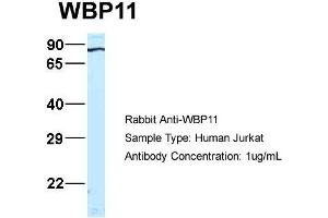 Host:  Rabbit  Target Name:  WB Sample Type:  Jurkat  Antibody Dilution:  1. (WBP11 Antikörper  (N-Term))