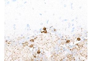 Immunohistochemistry (IHC) image for anti-Tyrosine Hydroxylase (TH) (AA 450-500) antibody (ABIN7449433) (Rekombinanter Tyrosine Hydroxylase Antikörper  (AA 450-500))