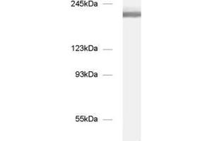 dilution: 1 : 1000, sample: mouse brain homogenate (NCAM 180 (AA 1-1115) Antikörper)