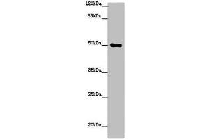 Western blot All lanes: TUBG1 antibody at 14 μg/mL + Hela whole cell lysate Secondary Goat polyclonal to rabbit IgG at 1/10000 dilution Predicted band size: 52 kDa Observed band size: 52 kDa (TUBG1 Antikörper  (AA 29-184))