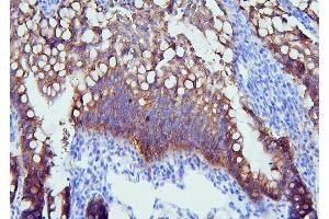 IHC analysis of PYROXD1 using anti-PYROXD1 antibody (ABIN6719650). (PYROXD1 Antikörper  (AA 48-230))
