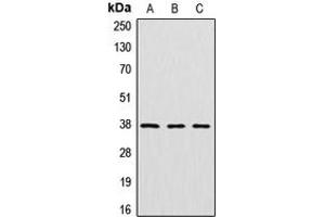 Western blot analysis of Cathepsin V expression in HeLa (A), mouse kidney (B), rat kidney (C) whole cell lysates. (Cathepsin L2 Antikörper  (Center))
