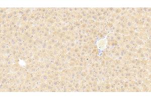 Immunohistochemistry (IHC) image for anti-Pyruvate Kinase, Liver and RBC (PKLR) (AA 114-323) antibody (ABIN7431305)