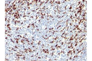 Formalin-fixed, paraffin-embedded human Tonsil stained with PD1 (CD279) Rabbit Polyclonal Antibody. (PD-1 Antikörper)