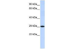 WB Suggested Anti-HSD17B14 Antibody Titration: 0. (HSD17B14 Antikörper  (Middle Region))
