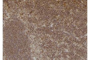 ABIN6276920 at 1/100 staining Mouse spleen tissue by IHC-P.