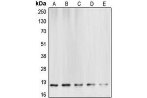 Western blot analysis of Caspase 6 p18 expression in HeLa (A), mouse brain (B), rat kidney (C), NIH3T3 staurosporine-treated (D), Jurkat etoposide-treated (E) whole cell lysates. (Caspase 6 p18 (Center) Antikörper)